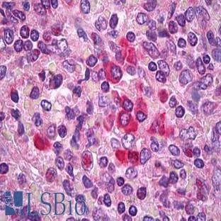 anti-B-Cell CLL/lymphoma 2 (BCL2) antibody avatar