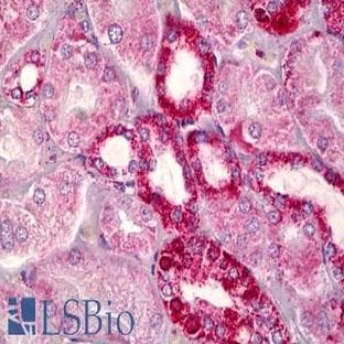 anti-B-Cell CLL/lymphoma 2 (BCL2) (AA 46-95) antibody avatar