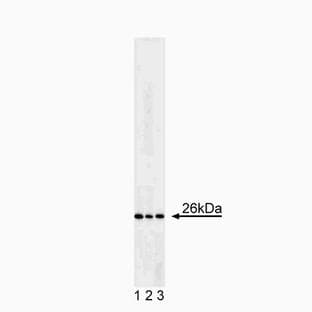anti-B-Cell CLL/lymphoma 2 (BCL2) antibody avatar