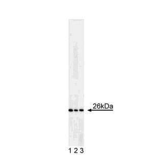 anti-B-Cell CLL/lymphoma 2 (BCL2) antibody avatar
