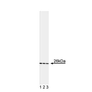 anti-B-Cell CLL/lymphoma 2 (BCL2) antibody avatar