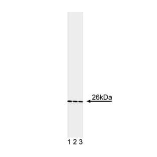 anti-B-Cell CLL/lymphoma 2 (BCL2) antibody avatar