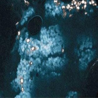 anti-B-Cell CLL/lymphoma 2 (BCL2) (AA 49-179) antibody avatar