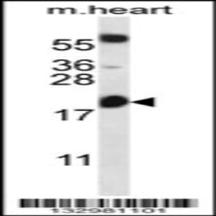 anti-B-Cell CLL/lymphoma 2 (BCL2) (AA 86-114), (Center) antibody avatar