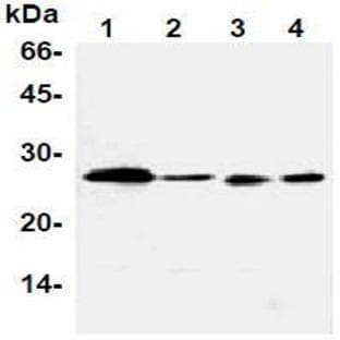 anti-B-Cell CLL/lymphoma 2 (BCL2) antibody avatar
