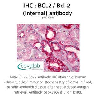 anti-B-Cell CLL/lymphoma 2 (BCL2) (Internal Region) antibody avatar