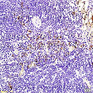 anti-B-Cell CLL/lymphoma 2 (BCL2) antibody avatar