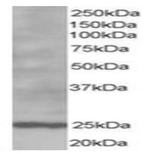 anti-B-Cell CLL/lymphoma 2 (BCL2) (N-Term) antibody avatar