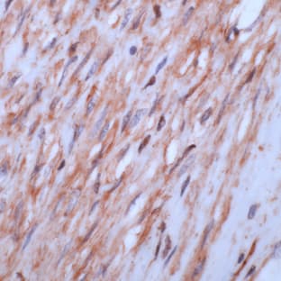 anti-Actin, beta (ACTB) (N-Term) antibody avatar