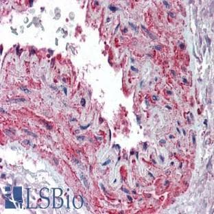 anti-Actin, beta (ACTB) (AA 359-368) antibody avatar