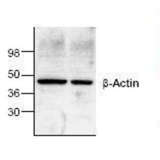 anti-Actin, beta (ACTB) antibody avatar
