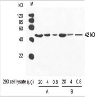 anti-Actin, beta (ACTB) antibody avatar