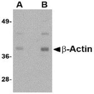 anti-Actin, beta (ACTB) (N-Term) antibody avatar