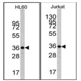 anti-Actin, beta (ACTB) antibody avatar
