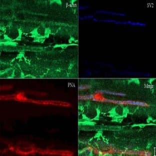 anti-Actin, beta (ACTB) (AA 359-368) antibody avatar