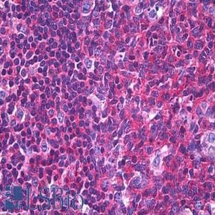 anti-Actin, beta (ACTB) antibody avatar