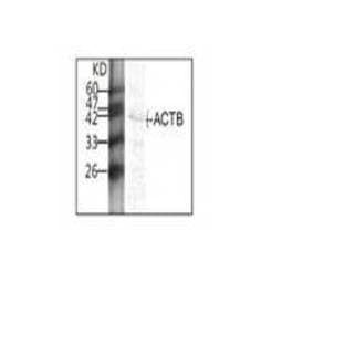 anti-Actin, beta (ACTB) antibody avatar