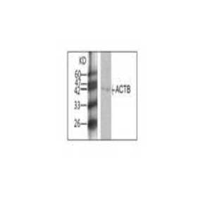 anti-Actin, beta (ACTB) antibody avatar