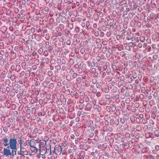 anti-Actin, beta (ACTB) (AA 2-16) antibody avatar