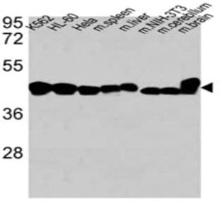 anti-Actin, beta (ACTB) antibody avatar