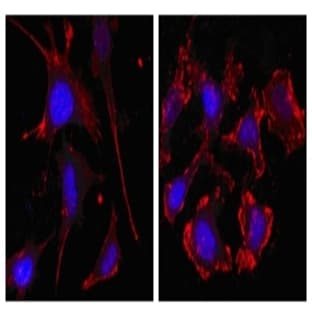 anti-Actin, beta (ACTB) antibody avatar