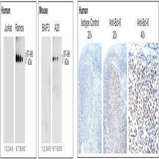 anti-B-Cell CLL/lymphoma 6 (BCL6) antibody avatar