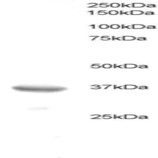anti-B-Cell CLL/lymphoma 7A (BCL7A) (C-Term) antibody avatar