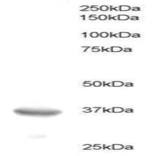 anti-B-Cell CLL/lymphoma 7A (BCL7A) (C-Term) antibody avatar