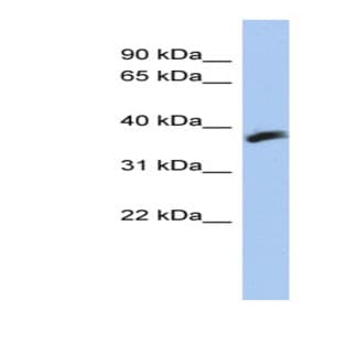 anti-Cytochrome B5 Reductase-Like (CYB5RL) (N-Term) antibody avatar