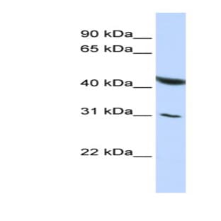 anti-CUGBP, Elav-Like Family Member 6 (CELF6) (Middle Region) antibody avatar