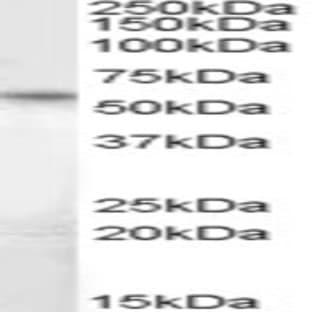 anti-CUGBP, Elav-Like Family Member 5 (CELF5) (N-Term), (Internal Region) antibody avatar