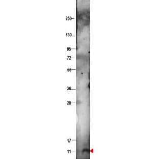 anti-Chemokine (C-X-C Motif) Ligand 10 (CXCL10) antibody avatar