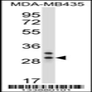 anti-Chymotrypsin-Like Elastase Family, Member 2A (CELA2A) (C-Term), (AA 231-260) antibody avatar