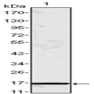 anti-Chemokine (C-C Motif) Ligand 2 (CCL2) antibody avatar