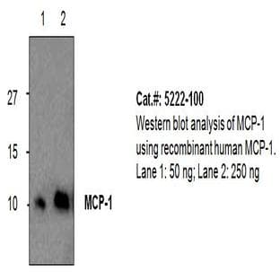 anti-Chemokine (C-C Motif) Ligand 2 (CCL2) antibody avatar