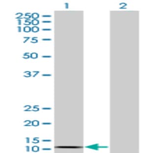 anti-Chemokine (C-C Motif) Ligand 2 (CCL2) (AA 1-99) antibody avatar
