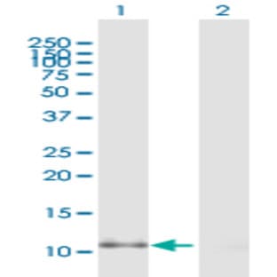 anti-Chemokine (C-C Motif) Ligand 2 (CCL2) (AA 1-99) antibody avatar