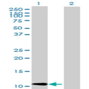 anti-Chemokine (C-C Motif) Ligand 2 (CCL2) (AA 1-99) antibody avatar