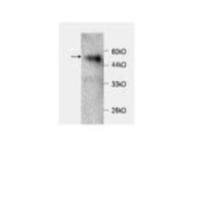 anti-Chemokine (C-C Motif) Ligand 2 (CCL2) antibody avatar