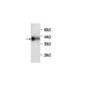 anti-Chemokine (C-C Motif) Ligand 2 (CCL2) antibody avatar