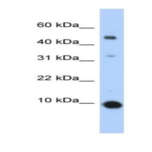 anti-Chemokine (C-C Motif) Ligand 2 (CCL2) antibody avatar