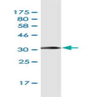 anti-Chemokine (C-C Motif) Ligand 2 (CCL2) (AA 1-99) antibody avatar