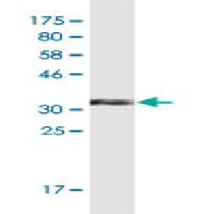 anti-Chemokine (C-C Motif) Ligand 2 (CCL2) (AA 1-99) antibody avatar