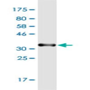 anti-Chemokine (C-C Motif) Ligand 2 (CCL2) (AA 1-99) antibody avatar