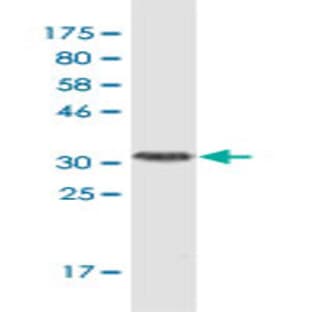 anti-Chemokine (C-C Motif) Ligand 2 (CCL2) (AA 1-99) antibody avatar