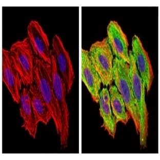 anti-Chemokine (C-C Motif) Ligand 2 (CCL2) antibody avatar
