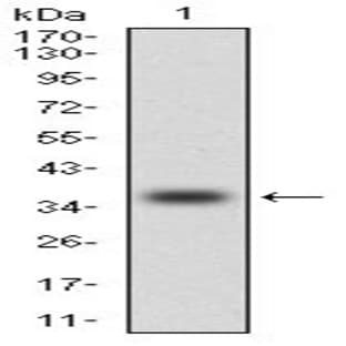 anti-Chemokine (C-C Motif) Ligand 2 (CCL2) antibody avatar