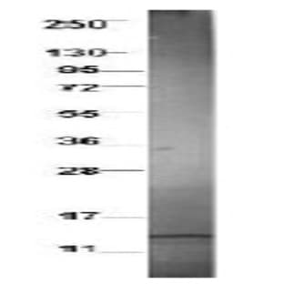 anti-Chemokine (C-C Motif) Ligand 3-Like 1 (CCL3L1) antibody avatar