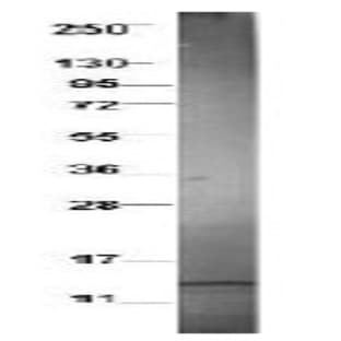 anti-Chemokine (C-C Motif) Ligand 3-Like 1 (CCL3L1) antibody avatar