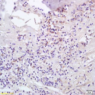 anti-Chemokine (C-C Motif) Ligand 5 (CCL5) (N-Term) antibody avatar
